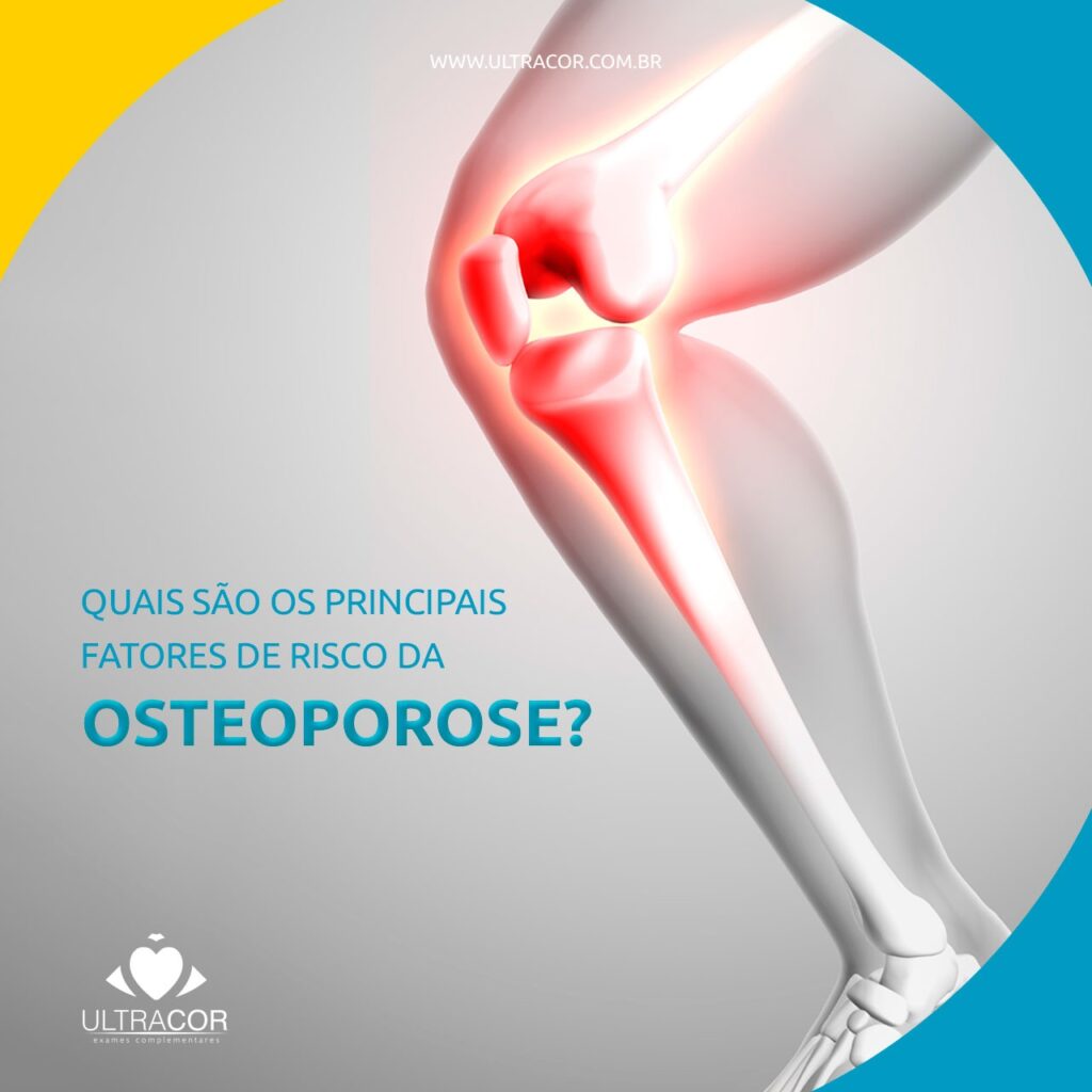 Quais S O Os Principais Fatores Da Osteoporose Ultracor