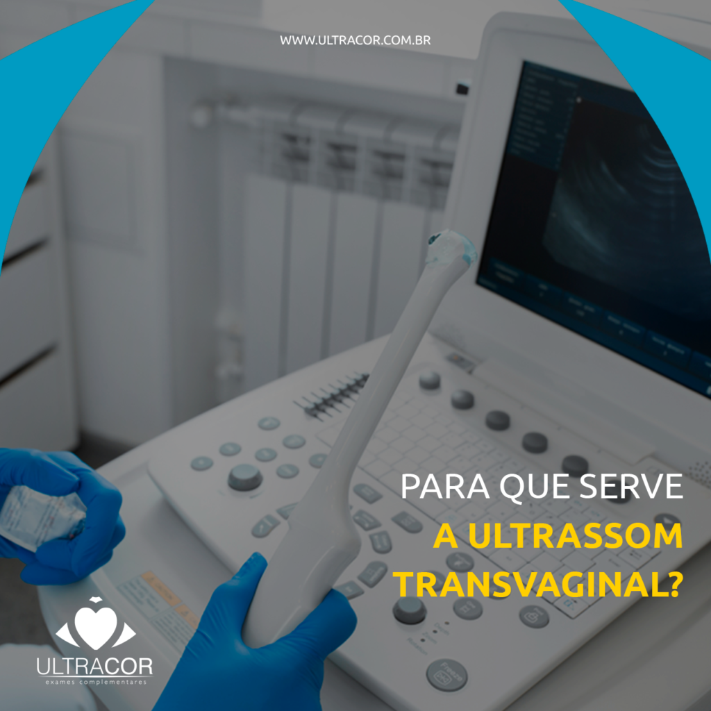 Para Que Serve A Ultrassom Transvaginal? - Ultracor